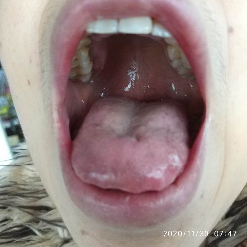 妈妈的舌头照片-20201130-1.jpg