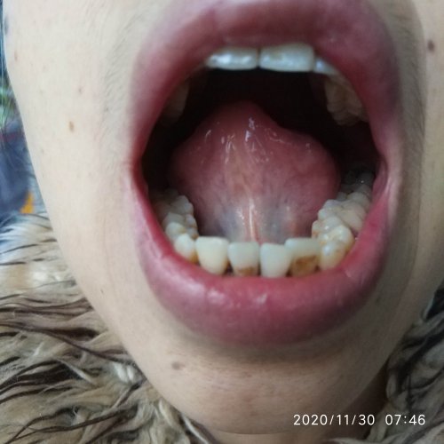 妈妈的舌头照片-20201130-2.jpg