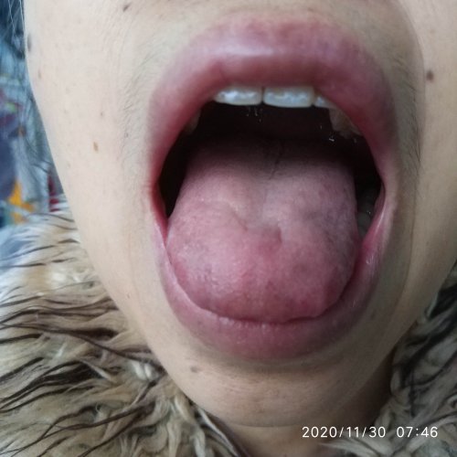 妈妈的舌头照片-20201130-4.jpg