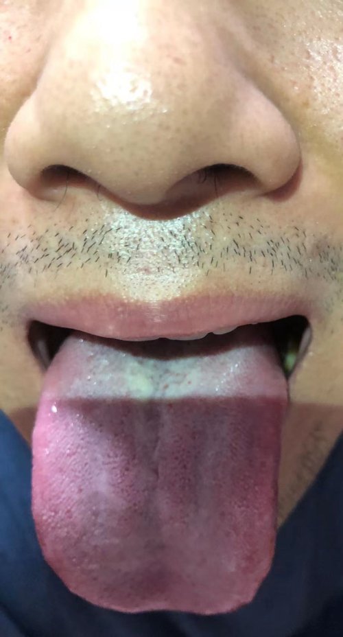 舌苔3.jpg
